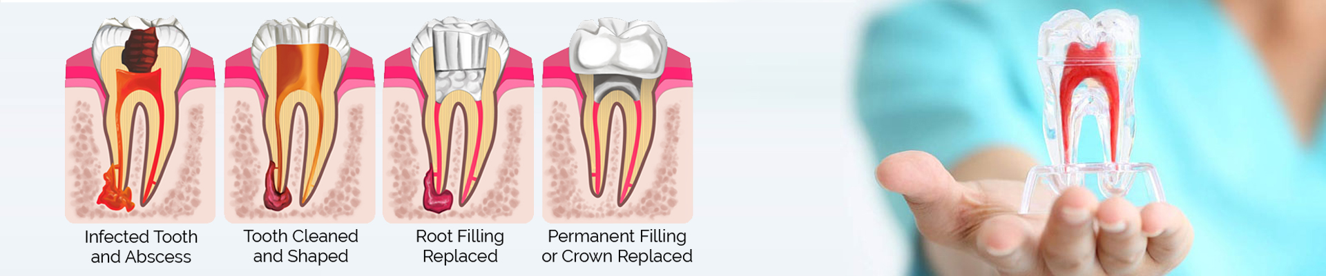 Endodontics