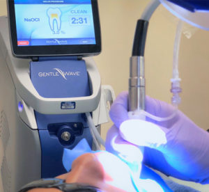 GentleWave Ultracleaning Procedure Performed at Center 4 Smiles